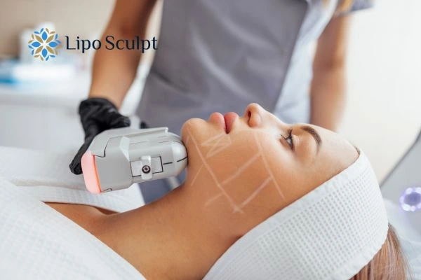 HIFU vs Botulinum Toxin: Understanding the Differences 1 HIFU vs Botox Oxshott What is the best option for you?