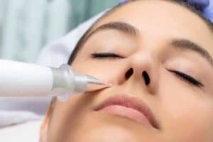 Best Actinic Keratoses Removal 3 Actinic keratoses Oxshott solutions - book in today!