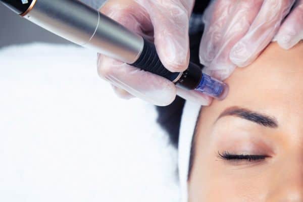 What Skin Concerns Can Total Skin Tightening Treatment Help With Oxshott?
