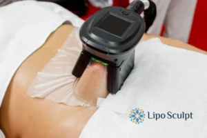 Does Fat Freezing At Home Work? 3 Fat freezing at home from Lipo Sculpt Oxshott